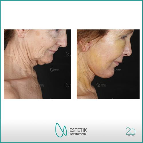 Before after photos of our patients 11